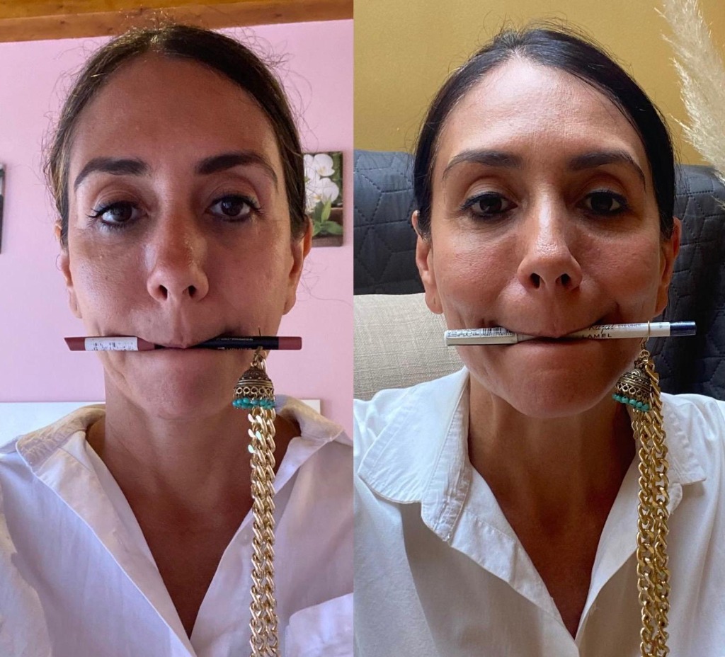 Dos años de evolución antes y después de Enknto